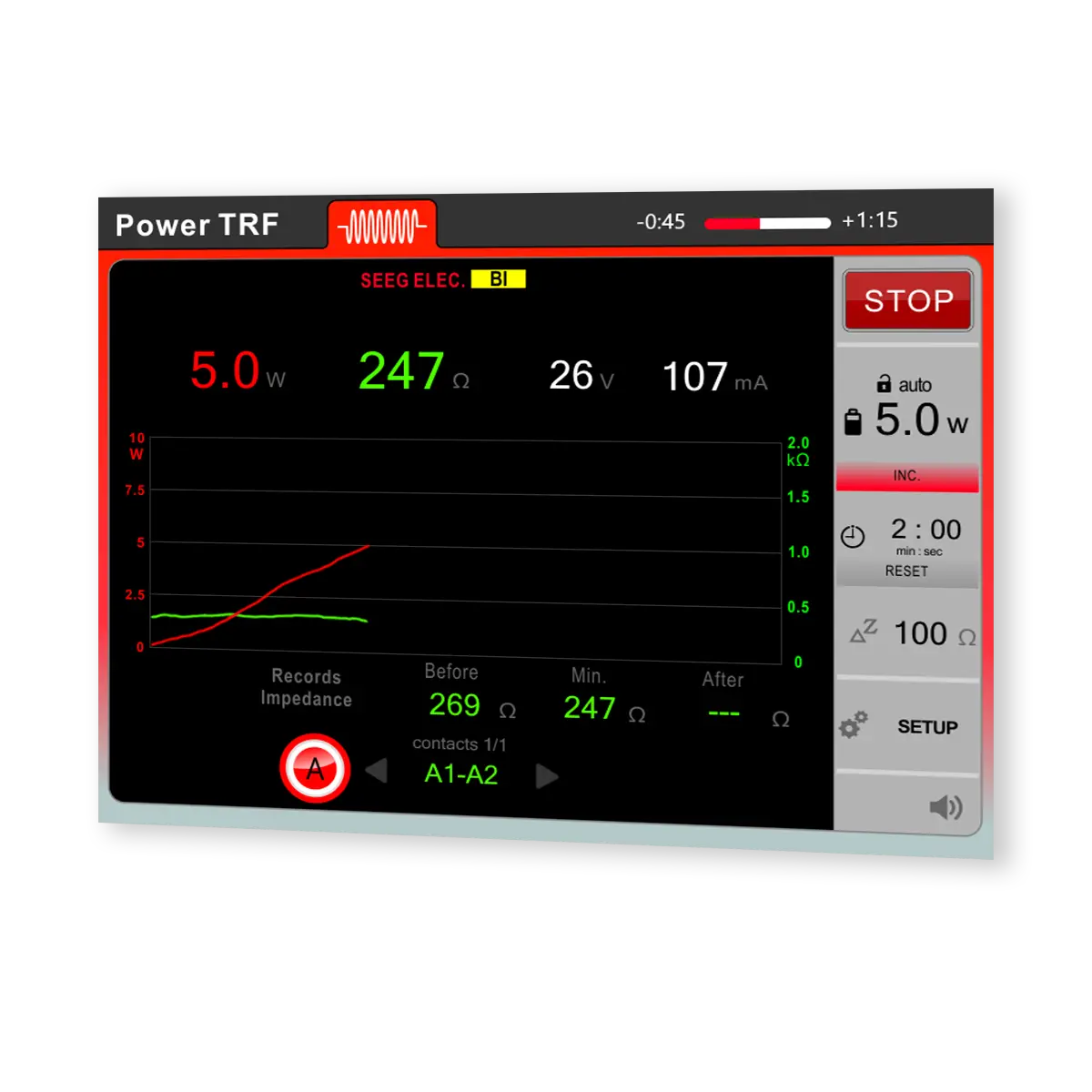 LG2-sEEG RF-Läsionsgenerator
