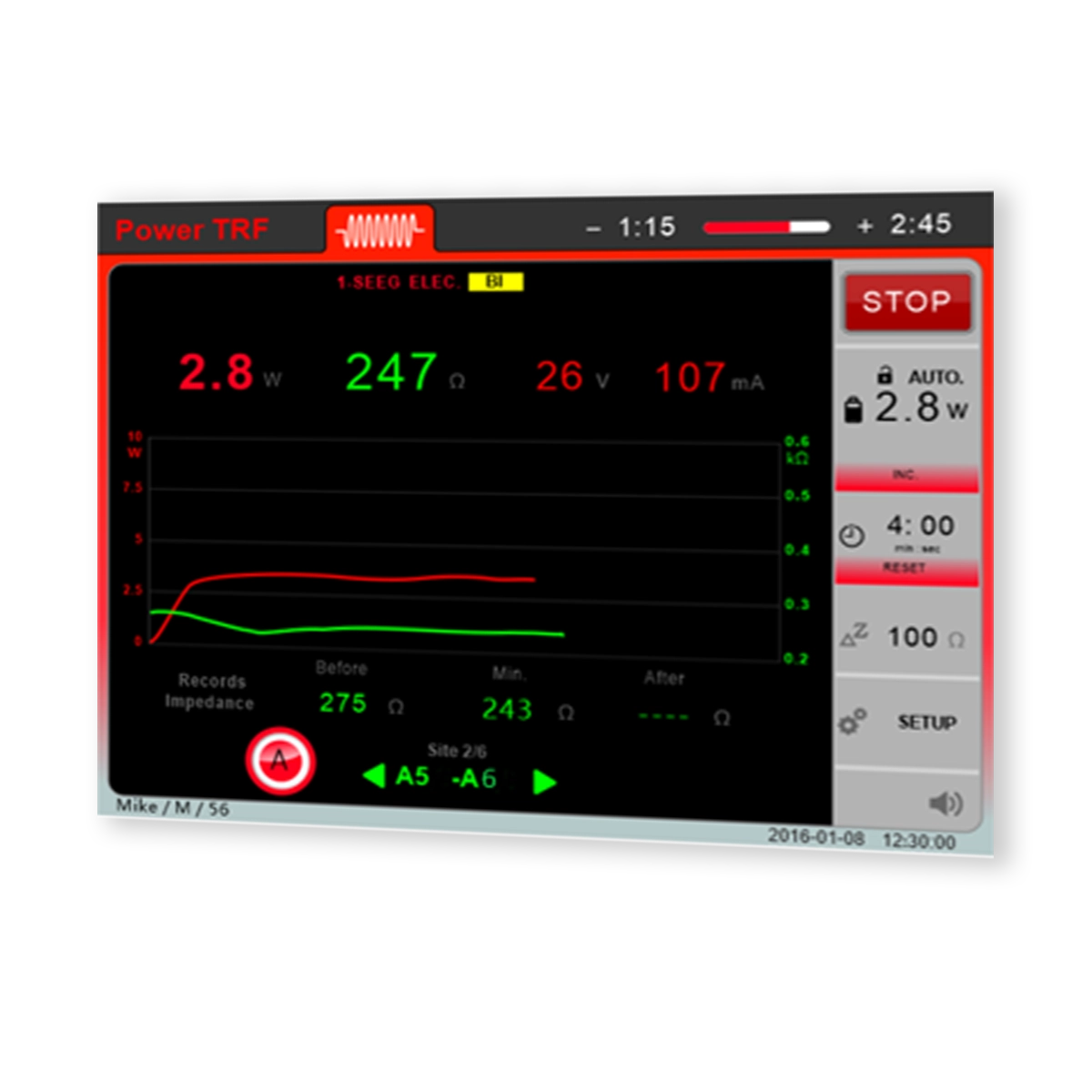 LG2-sEEG RF-Läsionsgenerator