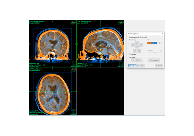 Fusions-Modul für iPS Automatische Image Fusion