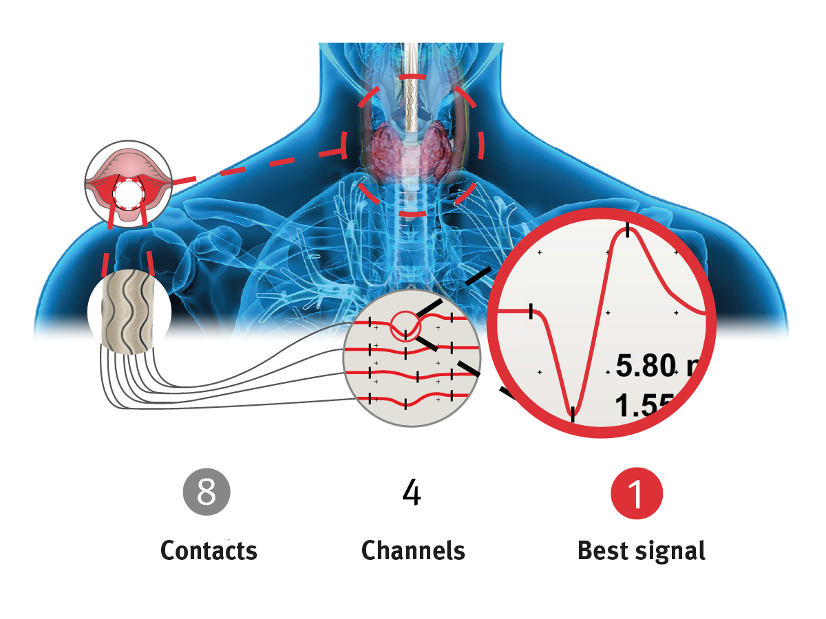 Illustration: functional principle of the tube electrode