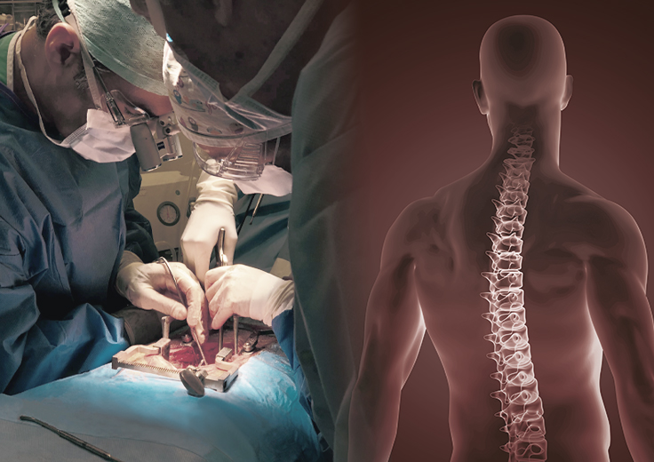 Foto: Wirbelsäulen-Operation, im Vordergrund Illustration der Wirbelsäule