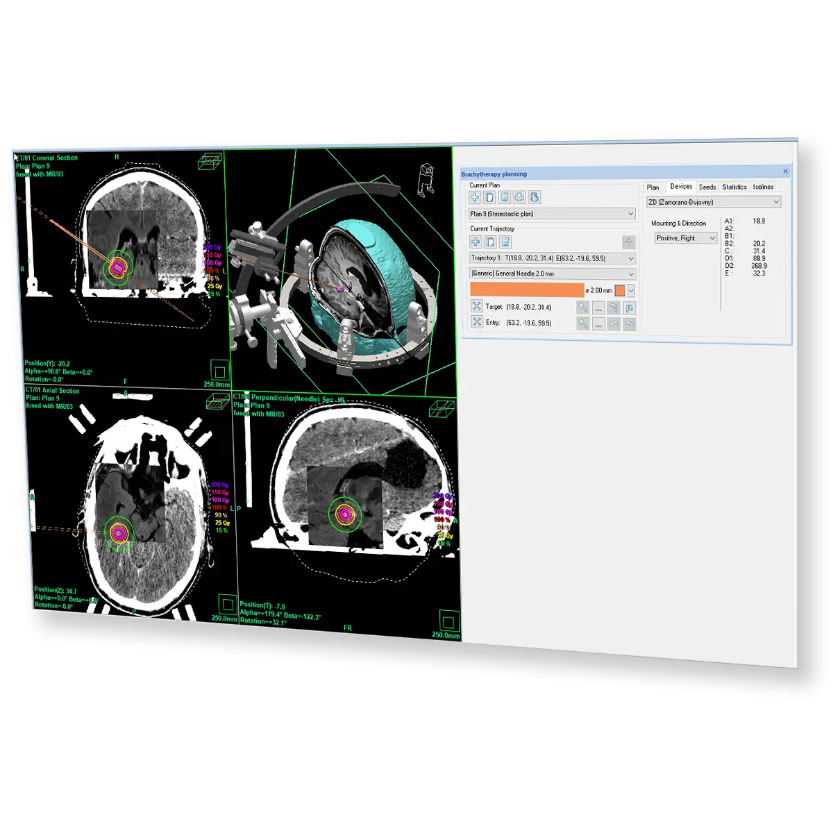 inomed Planning System (iPS)