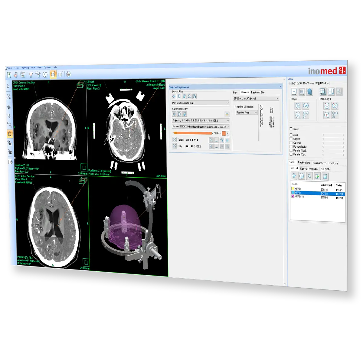 inomed Planning System (iPS)