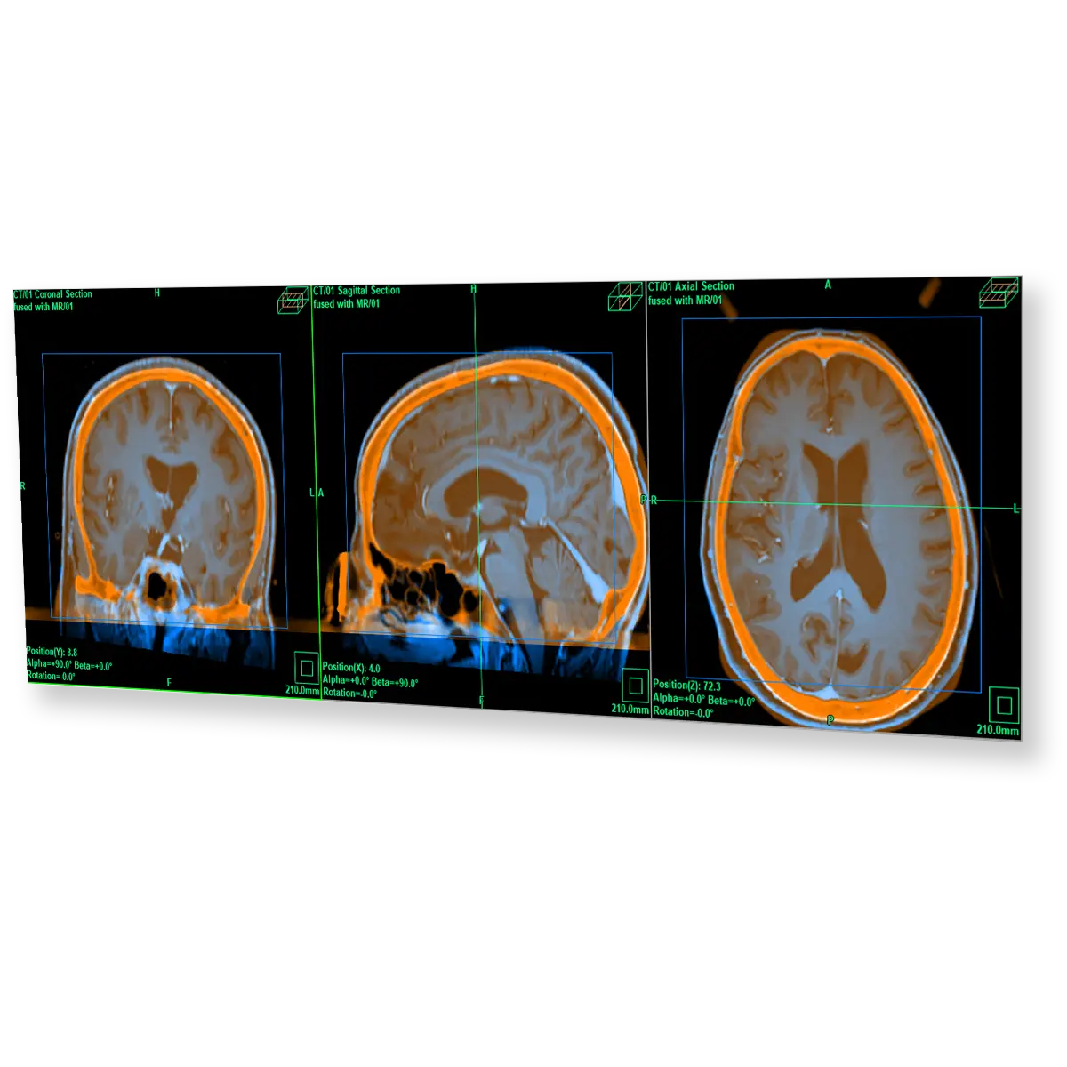 inomed Planning System (iPS)