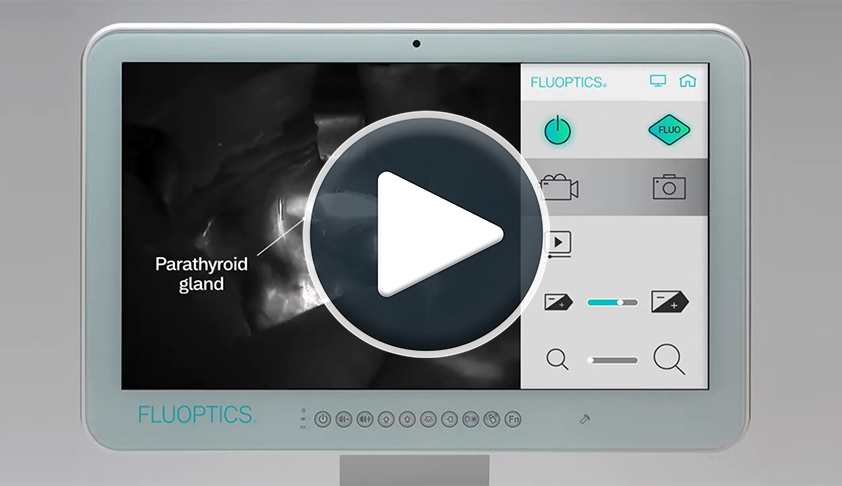 Link: YouTube Video FLUOBEAM®LX IN ACTION–Thyroid and Parathyroid surgery
