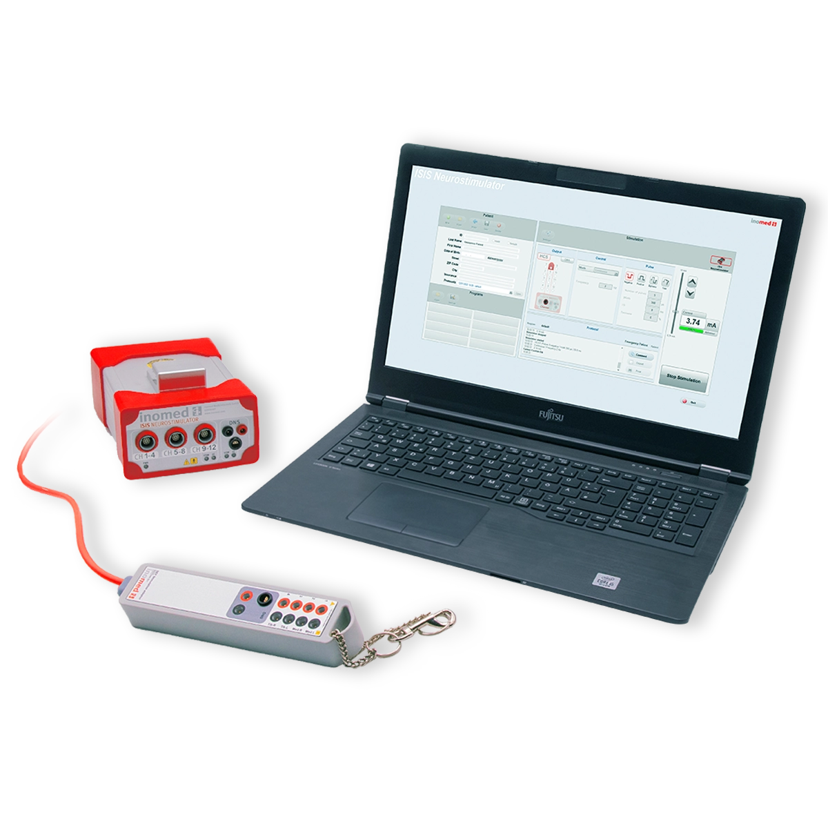 ISIS Neurostimulator