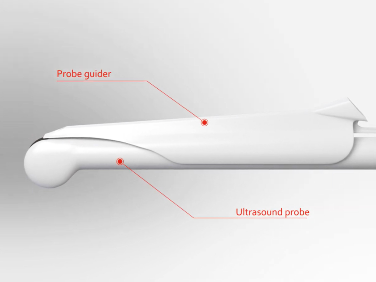 Graphic: needle guide attached to vaginal probe Graphic: needle guide attached to vaginal probe