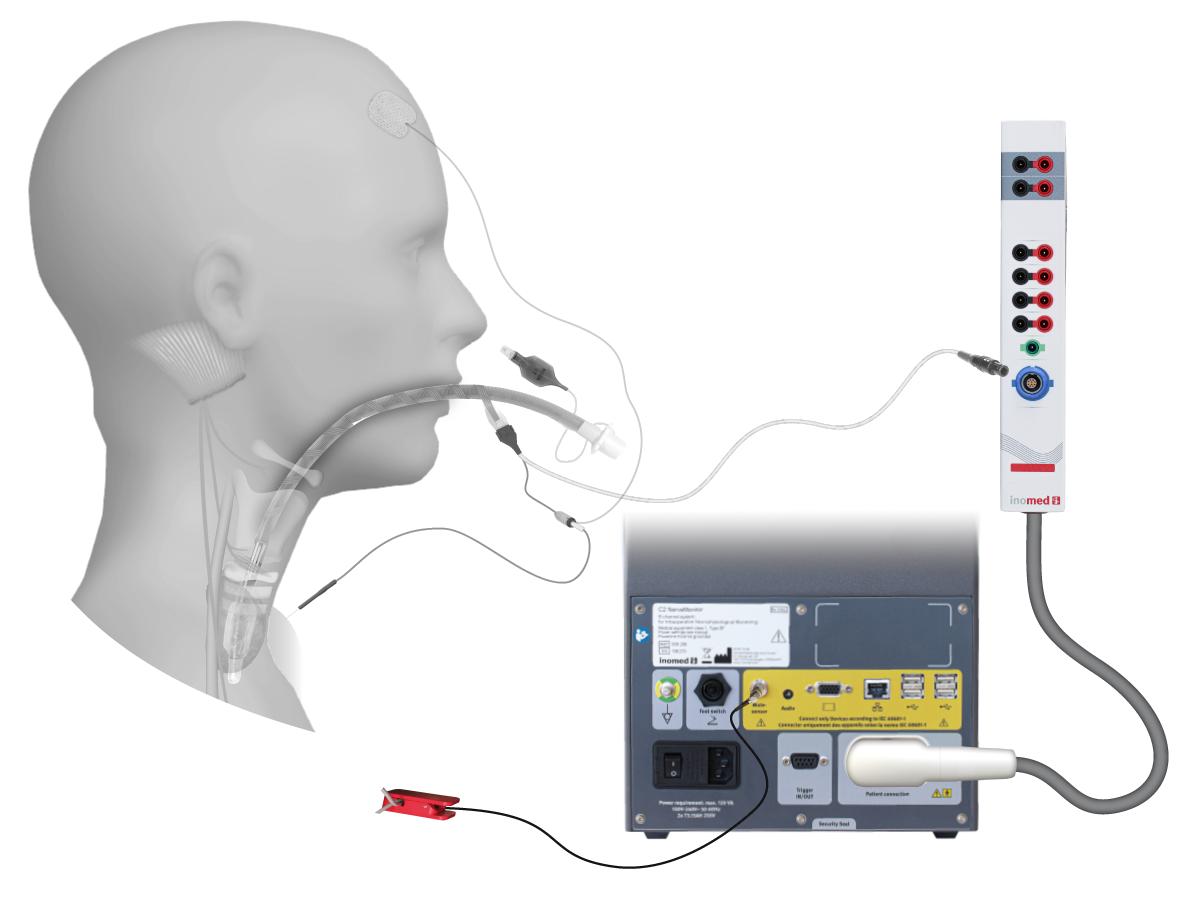 Illustration: devices involved Illustration: devices involved