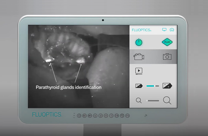 Foto: FLUOBEAM® LX Touchscreen