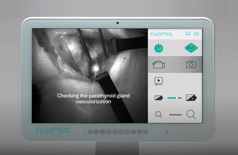 Foto: FLUOBEAM® LX Touchscreen mit ICG-Anzeige