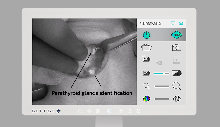 Photo: FLUOBEAM LX touchscreen Photo: FLUOBEAM LX touchscreen
