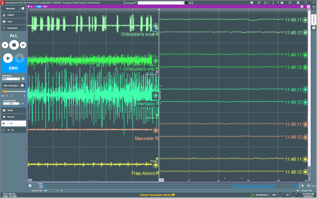 EMG activity EMG activity