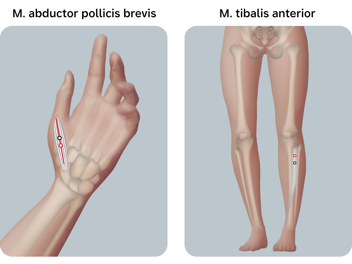 Illustration: Anatomische Lage von M. abductor pollicis brevis und M. tibialis anterior