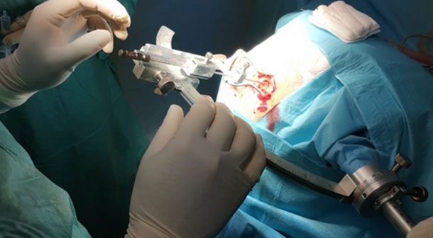Link: products funtional neurosurgery