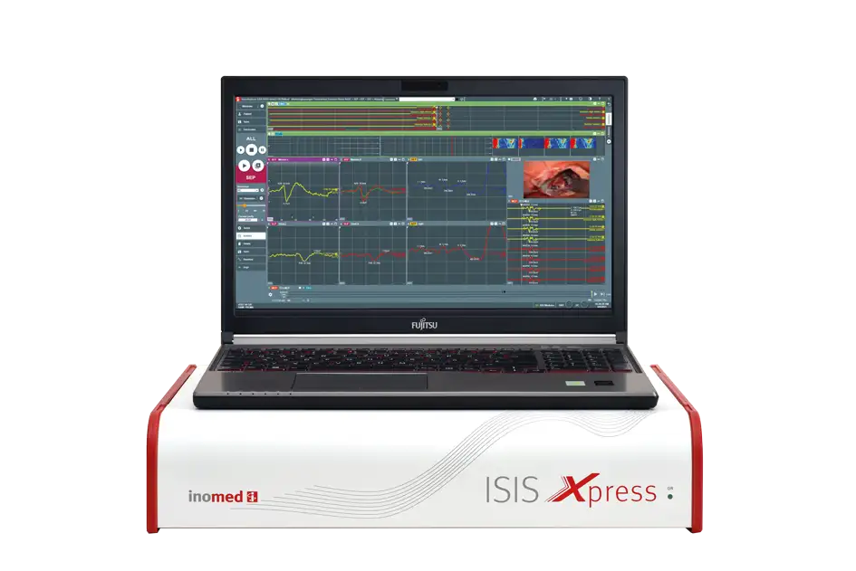 ISIS Xpress 32-channel system for neurosurgery