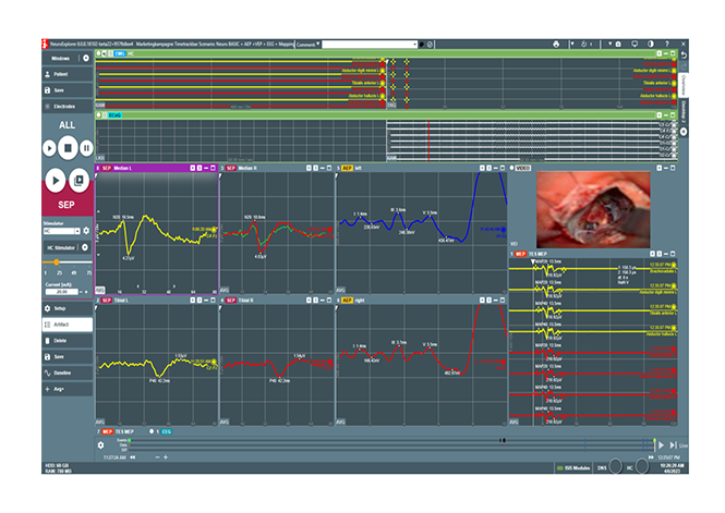 Video-Schnittstelle für ISIS IOM inkl. Software und Hardware