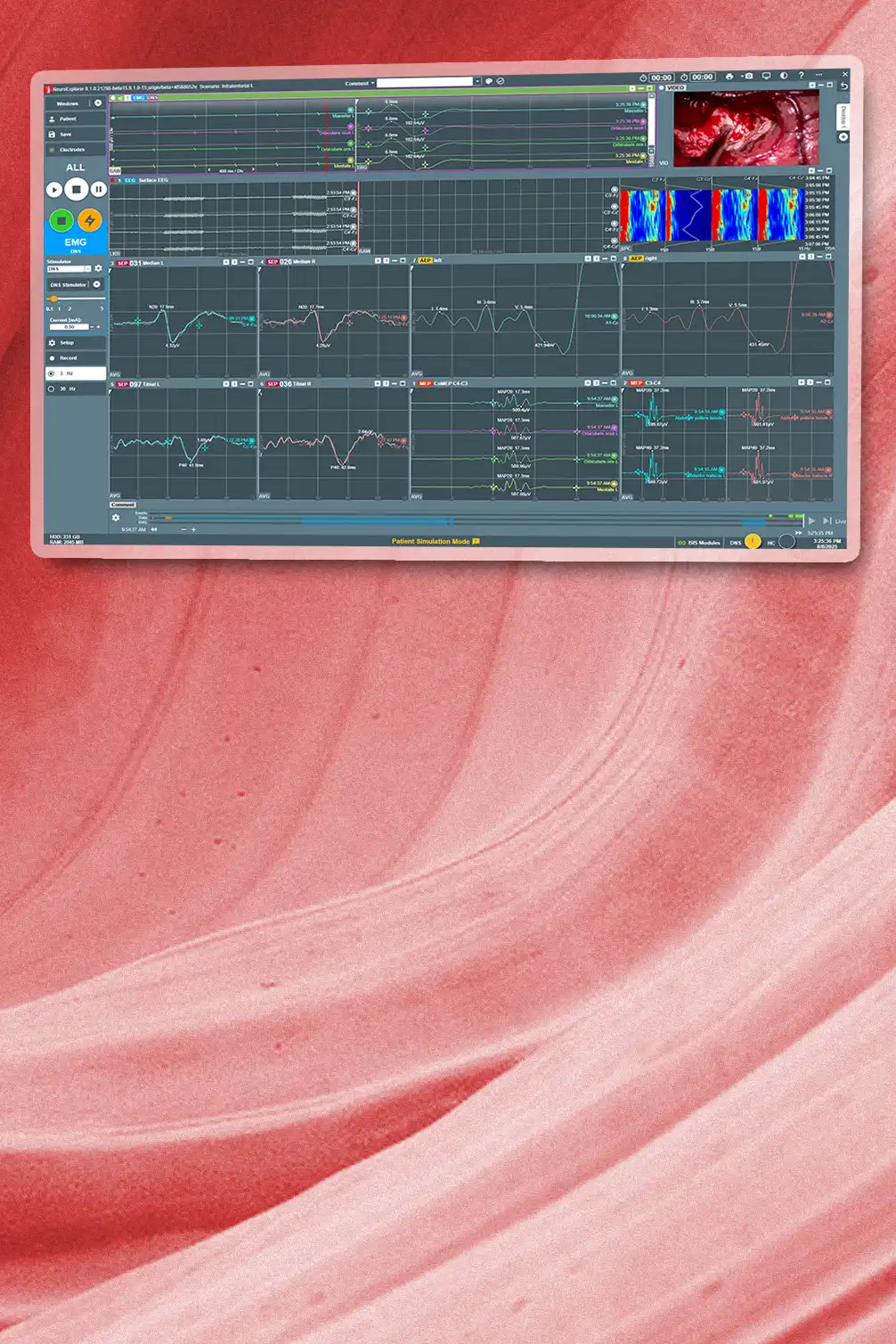 Photo: ISIS Xpert plus with NEX8