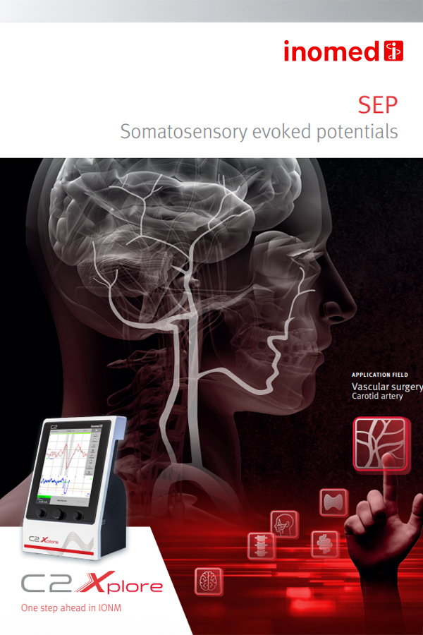 SEP – Somatosensory Evoked Potentials