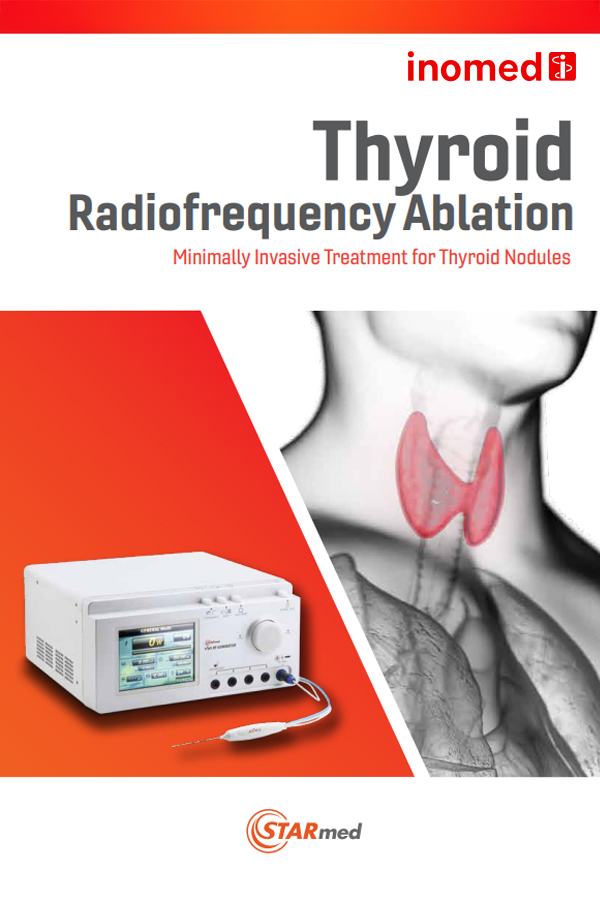 Thyroid RFA