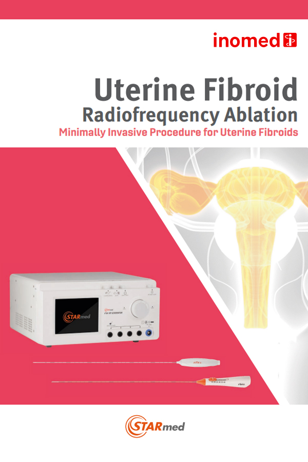 Uterine Fibroid RFA