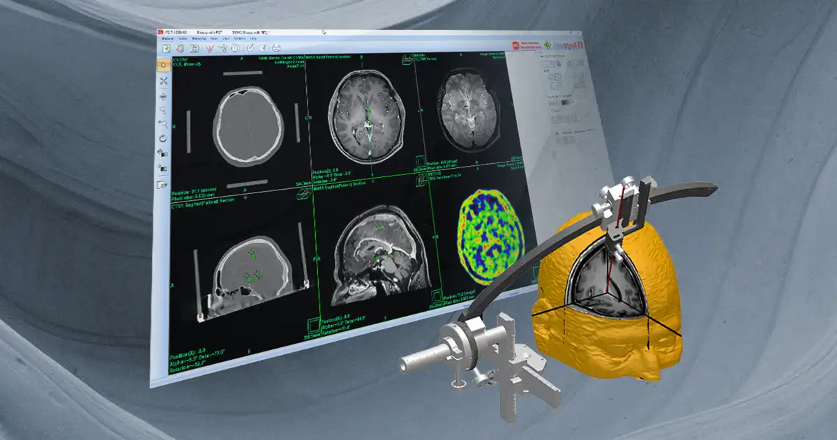 Link: inomed Planning System